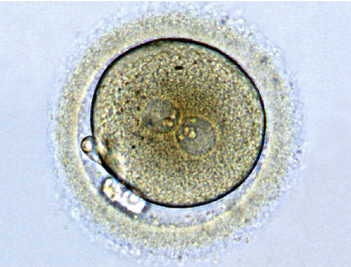 A 2PN atypically fertilised embryo