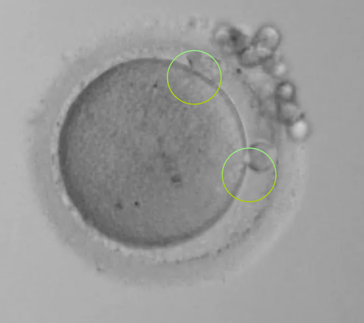 Is your clinic discarding viable embryos? The uncomfortable truth