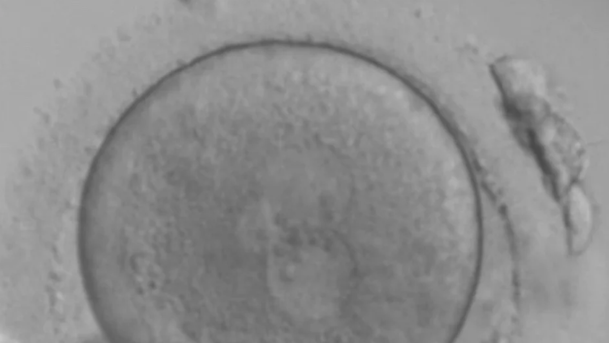 Unspoken outcomes: When IVF doesn’t go to plan